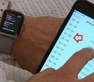 Apple Watch спасли жизнь 24-летнего парня