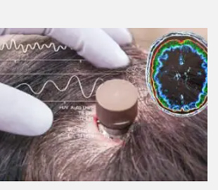 Розробники Neuralink розкрили проблеми мозкового чипа, які приховували роками