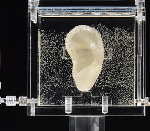 Врачи впервые пересадили человеку ухо из 3D-принтера
