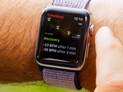 Apple бесплатно отремонтирует бракованные Apple Watch