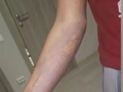 “Моя шкіра лущилася”: Африканська жінка розповіла, як її обманом змусили виготовляти “Шахеди” у Росії