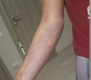 “Моя шкіра лущилася”: Африканська жінка розповіла, як її обманом змусили виготовляти “Шахеди” у Росії