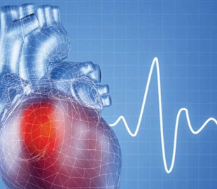 Як розпізнати та попередити інфаркт: поради лікарів