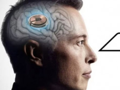 Neuralink шукає людей для випробування мозкового імпланта: деталі