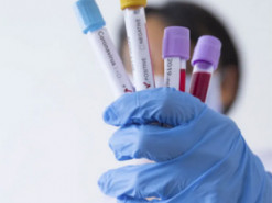 Не війною єдиною: на Київщині рівень захворюваності на коронавірус зріс на понад 40%