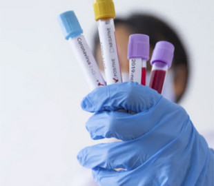 Не війною єдиною: на Київщині рівень захворюваності на коронавірус зріс на понад 40%