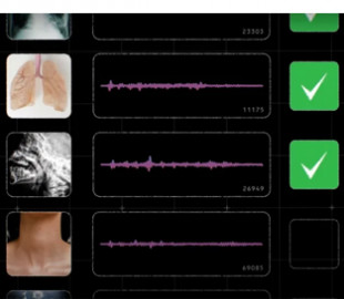 Проривна діагностика. ШІ-модель Google навчили визначати хворобу за звуком кашлю