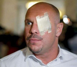 «Право слід поважати»: колишньому нардепу-зраднику Киві відмовили в апеляції у справі Катерини Гандзюк