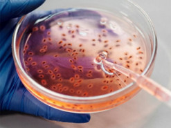 ШІ створив нові антибіотики проти супербактерій: що це за хвороби