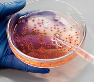 ШІ створив нові антибіотики проти супербактерій: що це за хвороби