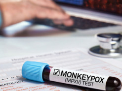 У США діагностували мавпячу віспу у двох дітей