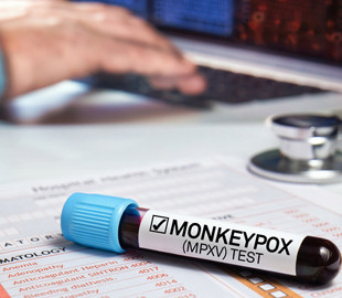 У США діагностували мавпячу віспу у двох дітей