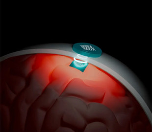 Науковці представили нейрочип BISC, що передає дані у сто разів швидше за аналоги