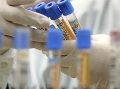 У 19 працівників Укртелекому тест на COVID-19 дав позитивний результат