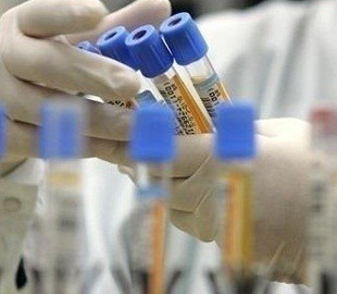 У 19 працівників Укртелекому тест на COVID-19 дав позитивний результат