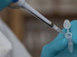 Українцям радять робити тест на коронавірус за будь-яких ознак застуди