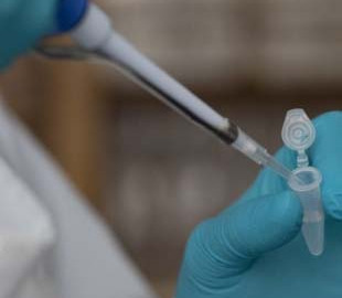 Українцям радять робити тест на коронавірус за будь-яких ознак застуди