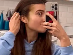 Jerry Heil показала величезну гематому на обличчі після падіння зі сцени