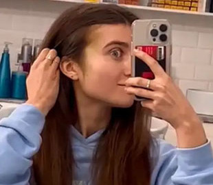 Jerry Heil показала величезну гематому на обличчі після падіння зі сцени