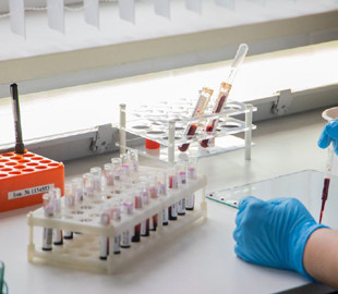 У Києві безкоштовно і швидко можна перевіритись на вірус гепатиту