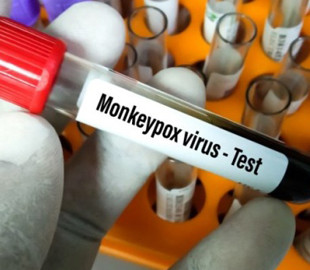 В Україні зафіксували чотири випадки мавпячої віспи