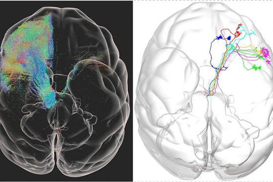 brain_01.jpg (142 KB)
