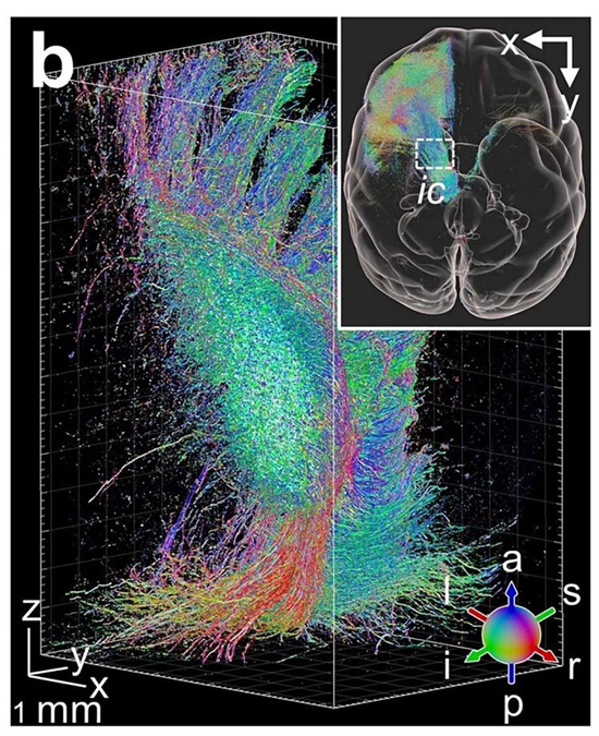 brain_02.jpg (361 KB)